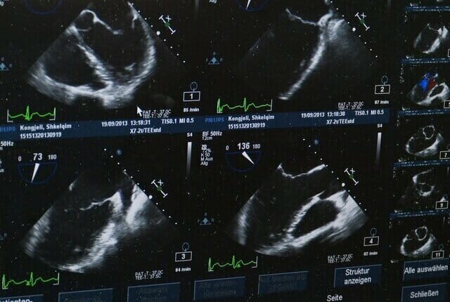 Houston Texas Lawyer