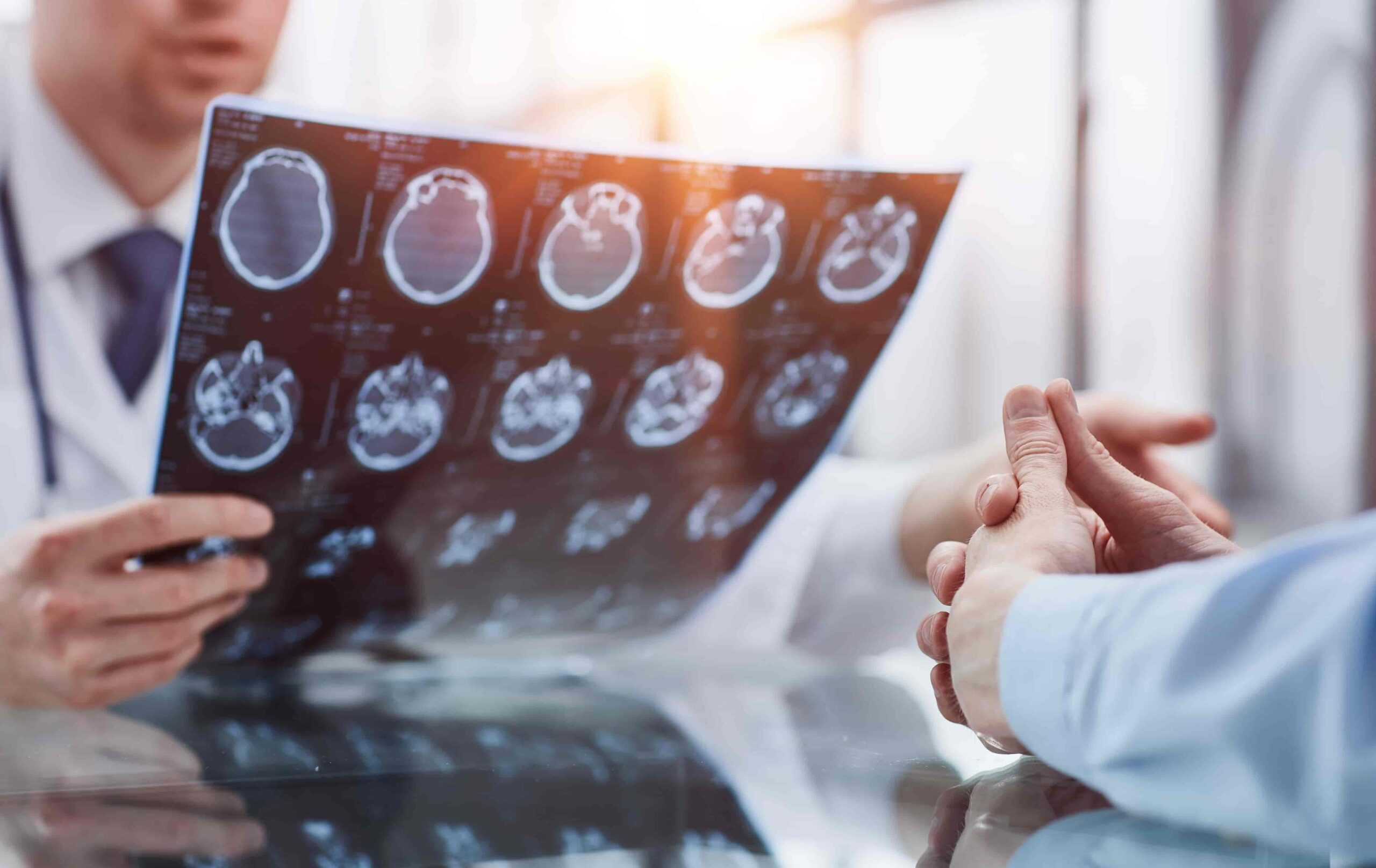 Doctor reviewing brain scan images with a patient during a medical consultation.